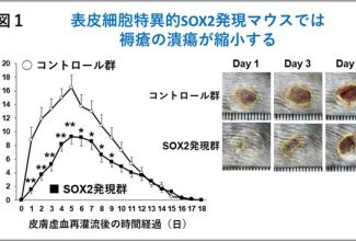 アイキャッチ-表⽪細胞における転写因⼦SOX2 が褥瘡の発症抑制に関わることを解明_R050731