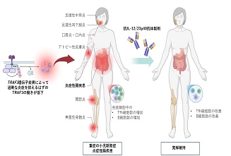はるきち プレスリリース】炎症性腸疾患(IBD)の発症に関与する新たな遺伝子変異