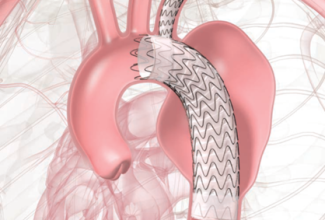 導入リリース・循環器外科_R080126