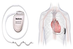 循環器内科_導入リリース_R080325