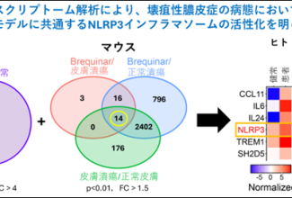 皮膚科学・研究成果リリース_R080807